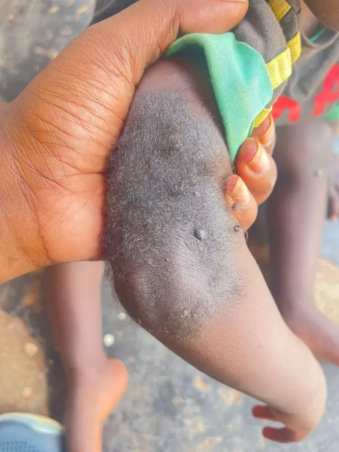 Help with Imre Wasswa's Operation